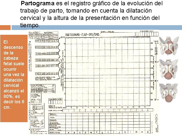 Partograma es el registro gráfico de la evolución del trabajo de parto, tomando en Partograma es el registro gráfico de la evolución del trabajo de parto, tomando en