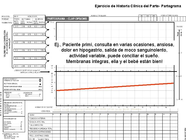 Ejercicio de Historia Clínica del Parto- Partograma Ej. , Paciente primi, consulta en varias Ejercicio de Historia Clínica del Parto- Partograma Ej. , Paciente primi, consulta en varias