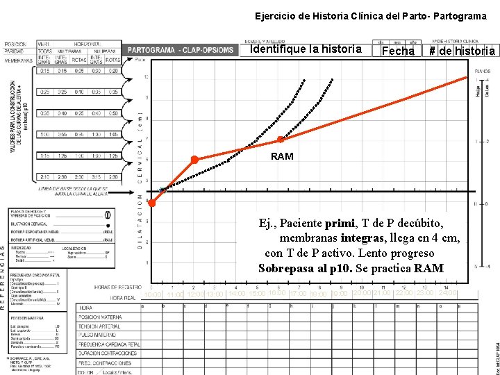 Ejercicio de Historia Clínica del Parto- Partograma Identifique la historia Fecha # de historia Ejercicio de Historia Clínica del Parto- Partograma Identifique la historia Fecha # de historia