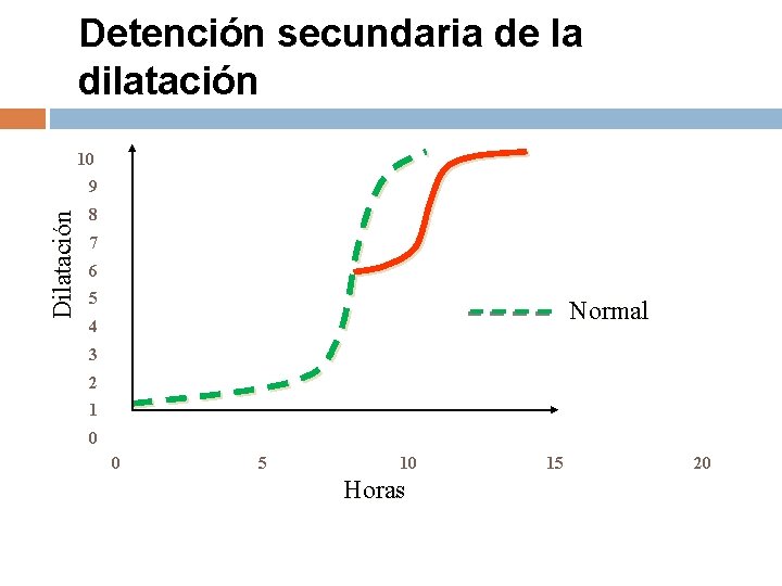 Detención secundaria de la dilatación 10 Dilatación 9 8 7 6 5 Normal 4 Detención secundaria de la dilatación 10 Dilatación 9 8 7 6 5 Normal 4