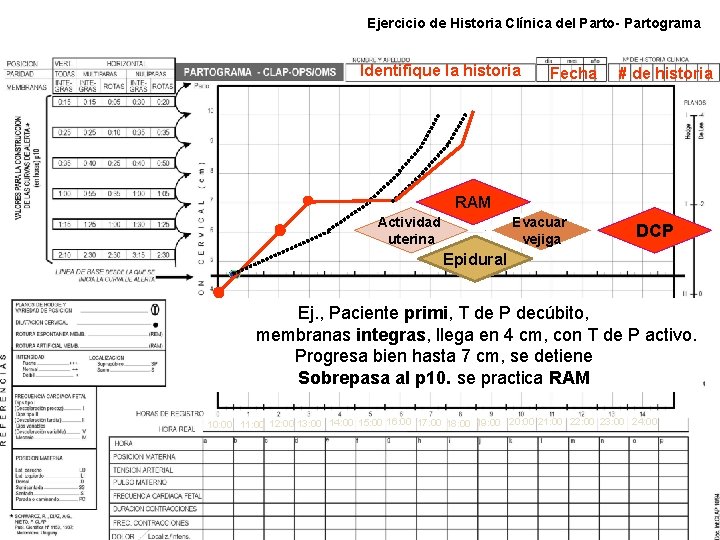 Ejercicio de Historia Clínica del Parto- Partograma Identifique la historia Fecha # de historia Ejercicio de Historia Clínica del Parto- Partograma Identifique la historia Fecha # de historia