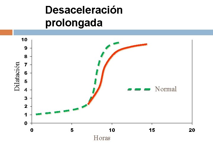 Dilatación Desaceleración prolongada Normal Horas Dilatación Desaceleración prolongada Normal Horas