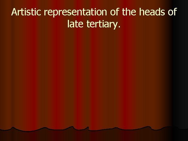 Artistic representation of the heads of late tertiary. 