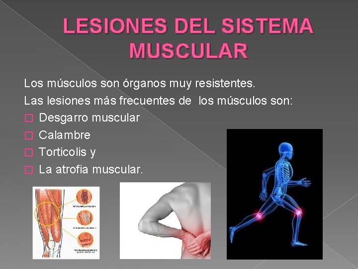 LESIONES DEL SISTEMA MUSCULAR Los músculos son órganos muy resistentes. Las lesiones más frecuentes