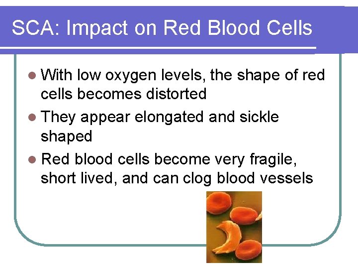 SCA: Impact on Red Blood Cells l With low oxygen levels, the shape of
