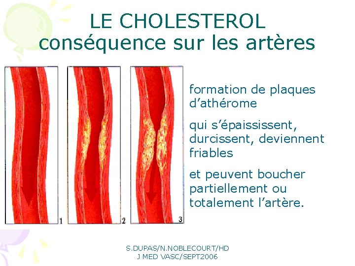 LE CHOLESTEROL conséquence sur les artères formation de plaques d’athérome qui s’épaississent, durcissent, deviennent