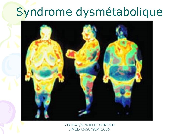 Syndrome dysmétabolique S. DUPAS/N. NOBLECOURT/HD J MED VASC/SEPT 2006 