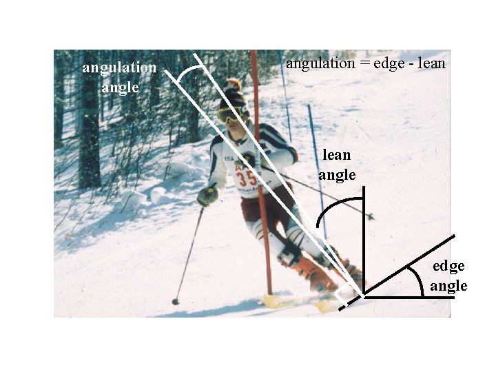 angulation angle angulation = edge - lean angle edge angle 