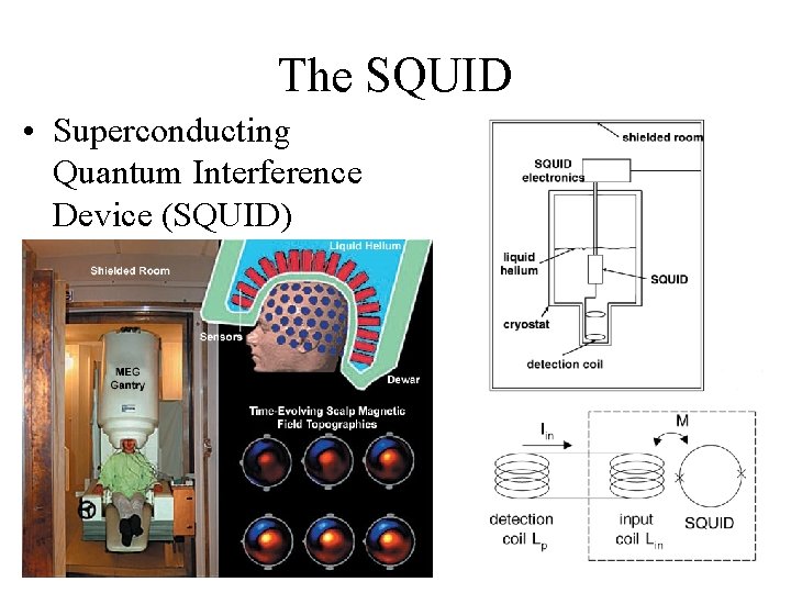 The SQUID • Superconducting Quantum Interference Device (SQUID) 