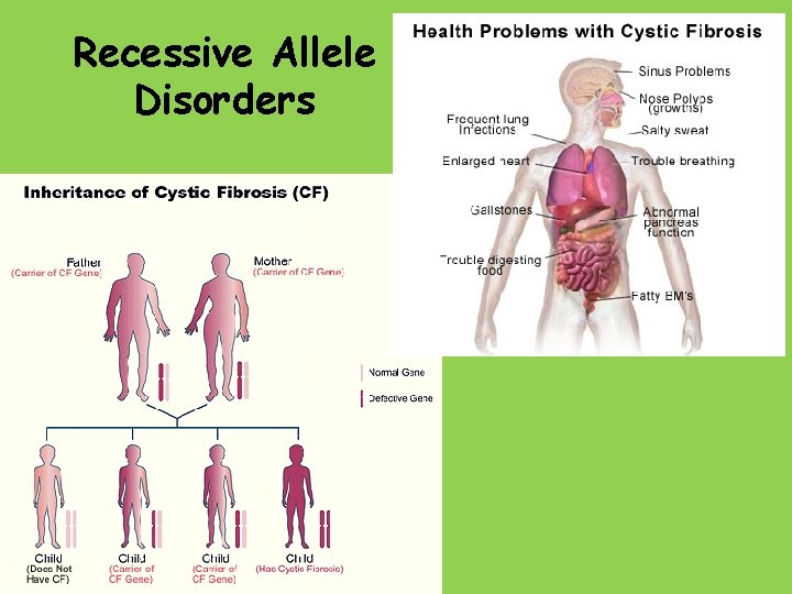 Recessive Allele Disorders 