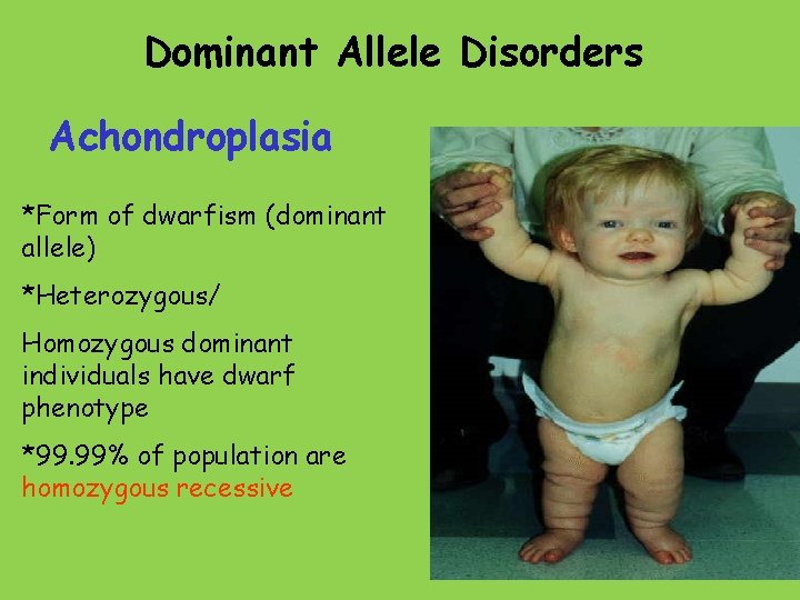 Dominant Allele Disorders Achondroplasia *Form of dwarfism (dominant allele) *Heterozygous/ Homozygous dominant individuals have