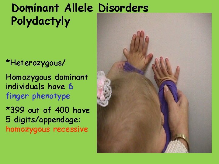 Dominant Allele Disorders Polydactyly *Heterozygous/ Homozygous dominant individuals have 6 finger phenotype *399 out