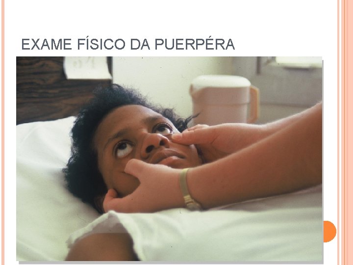 EXAME FÍSICO DA PUERPÉRA 