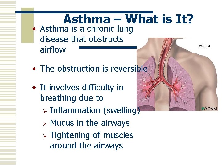 Asthma – What is It? w Asthma is a chronic lung disease that obstructs