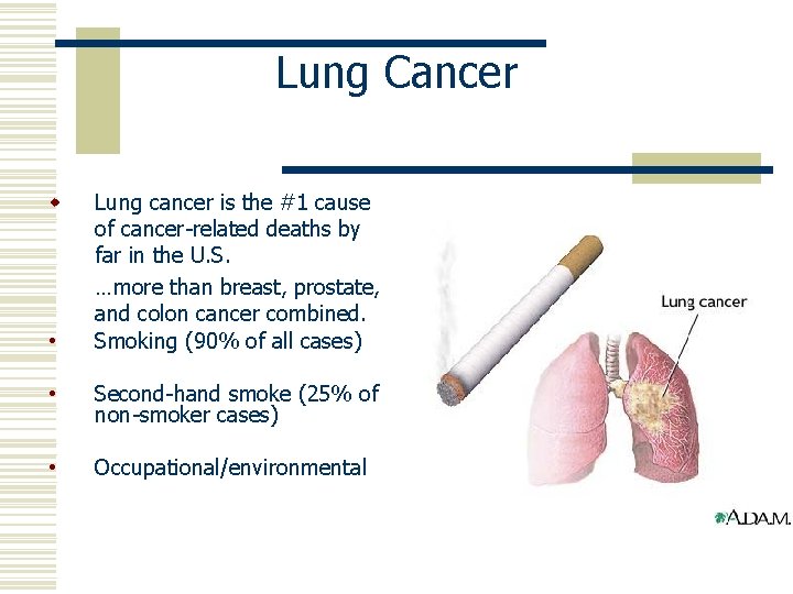 Lung Cancer w • Lung cancer is the #1 cause of cancer-related deaths by