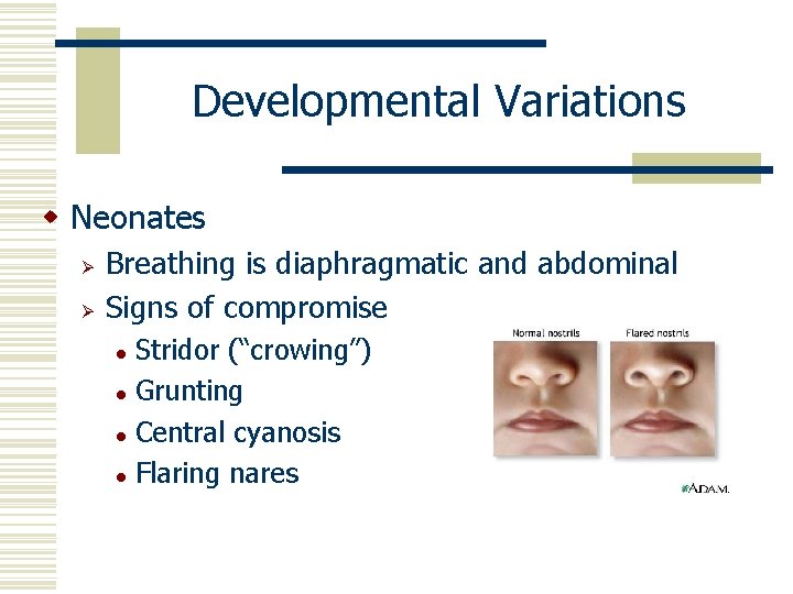 Developmental Variations w Neonates Ø Ø Breathing is diaphragmatic and abdominal Signs of compromise