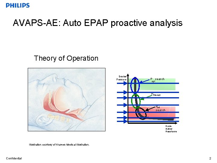 AVAPS-AE: Auto EPAP proactive analysis Theory of Operation Device Pressure P search opt Ptherapy