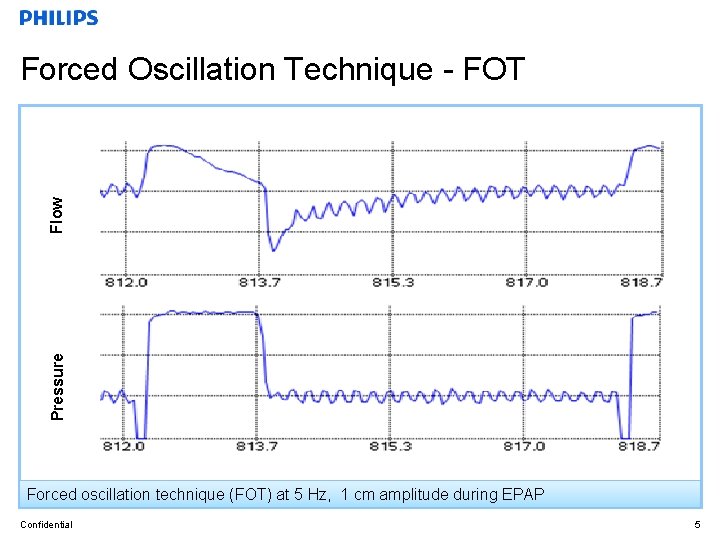 Pressure Flow Forced Oscillation Technique - FOT Forced oscillation technique (FOT) at 5 Hz,