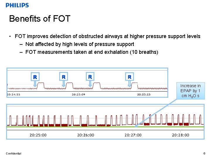 Benefits of FOT • FOT improves detection of obstructed airways at higher pressure support