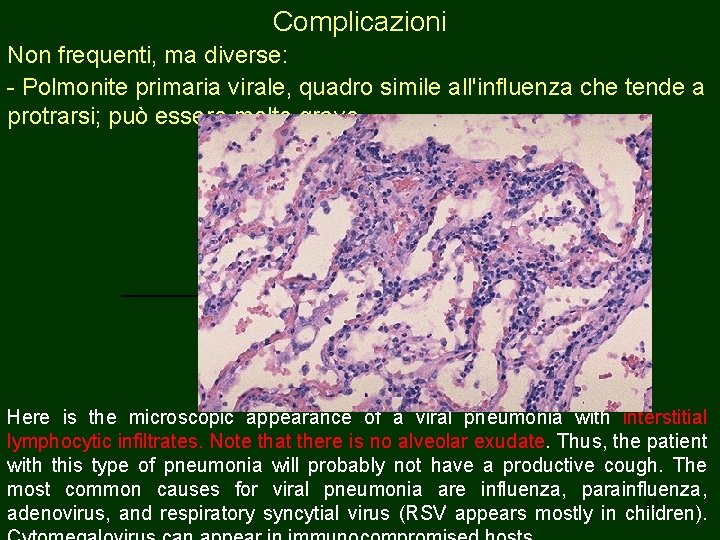 Complicazioni Non frequenti, ma diverse: - Polmonite primaria virale, quadro simile all'influenza che tende