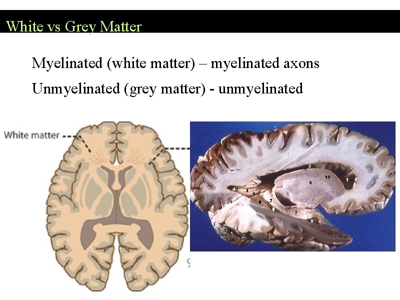 White vs Grey Matter Myelinated (white matter) – myelinated axons Unmyelinated (grey matter) -