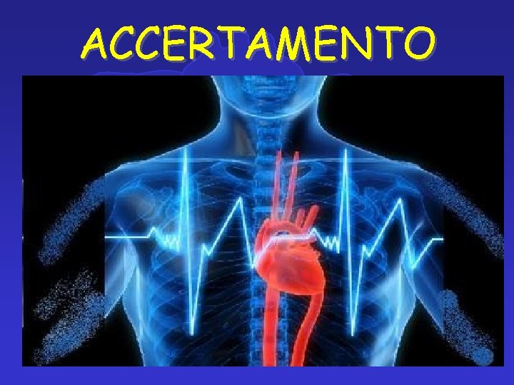 ACCERTAMENTO 