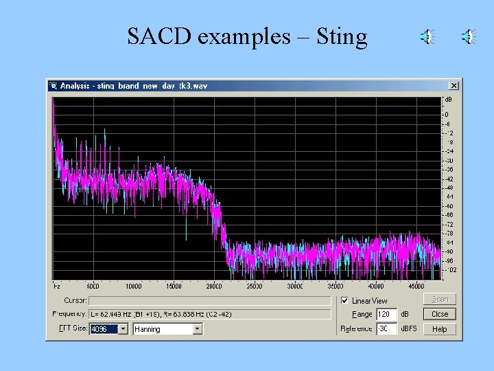 SACD examples – Sting 