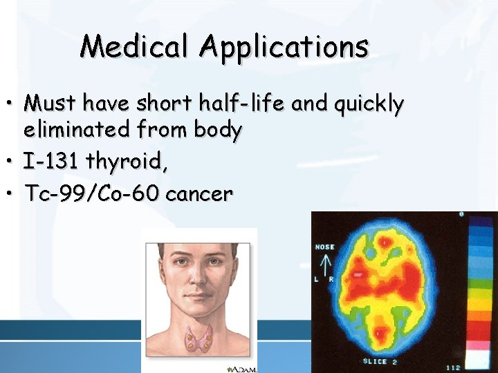 Medical Applications • Must have short half-life and quickly eliminated from body • I-131