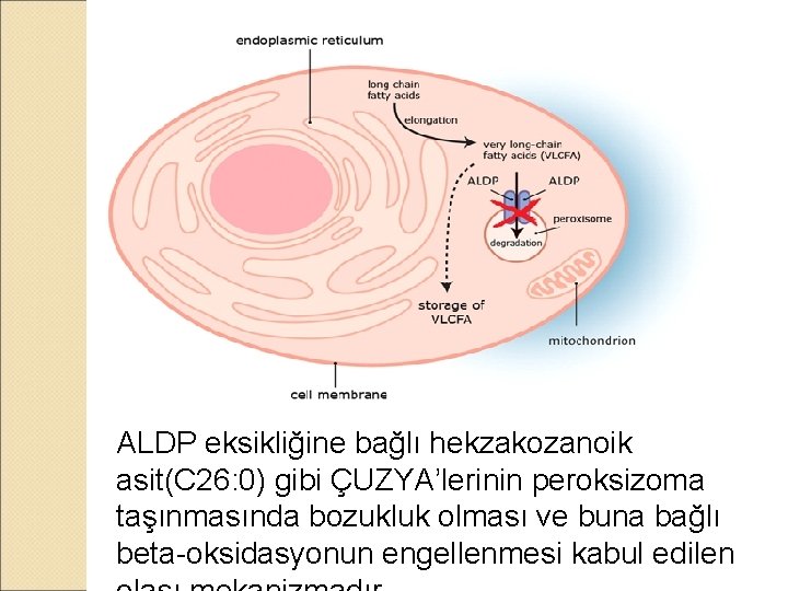 ALDP eksikliğine bağlı hekzakozanoik asit(C 26: 0) gibi ÇUZYA’lerinin peroksizoma taşınmasında bozukluk olması ve