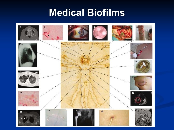 Biofilm Based Wound Care Planktonic vs Biofilm Overview