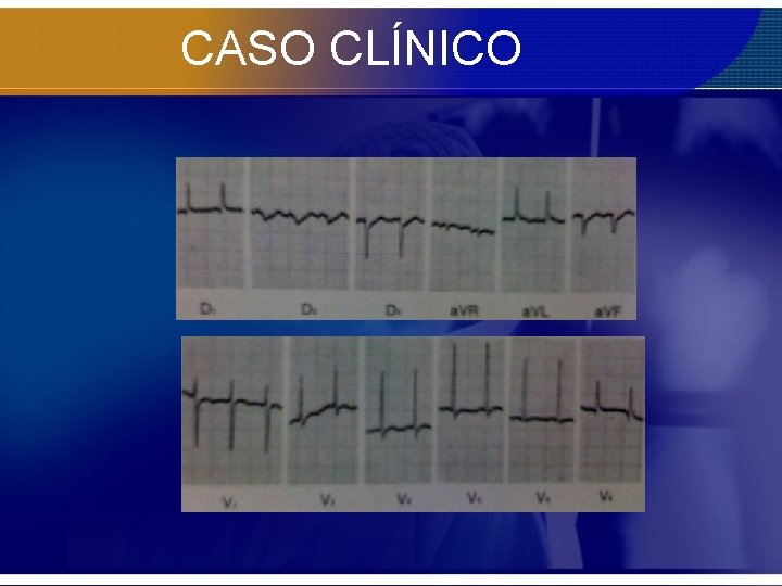 CASO CLÍNICO 