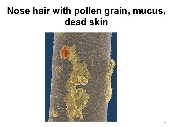 Nose hair with pollen grain, mucus, dead skin 17 