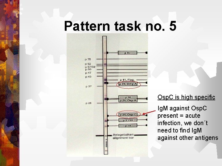 Pattern task no. 5 Osp. C is high specific Ig. M against Osp. C