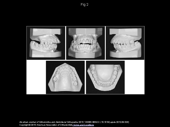 Fig 2 American Journal of Orthodontics and Dentofacial Orthopedics 2013 144455 -465 DOI: (10.