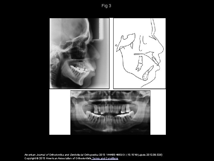 Fig 3 American Journal of Orthodontics and Dentofacial Orthopedics 2013 144455 -465 DOI: (10.