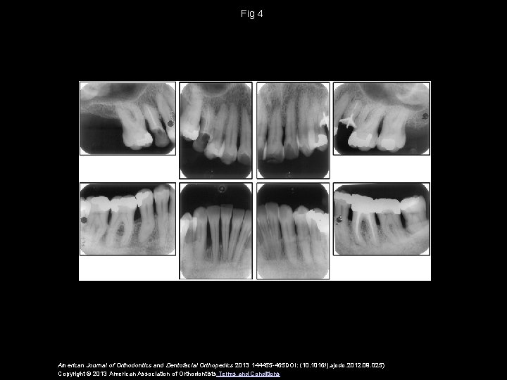 Fig 4 American Journal of Orthodontics and Dentofacial Orthopedics 2013 144455 -465 DOI: (10.