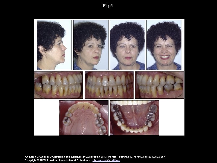 Fig 5 American Journal of Orthodontics and Dentofacial Orthopedics 2013 144455 -465 DOI: (10.