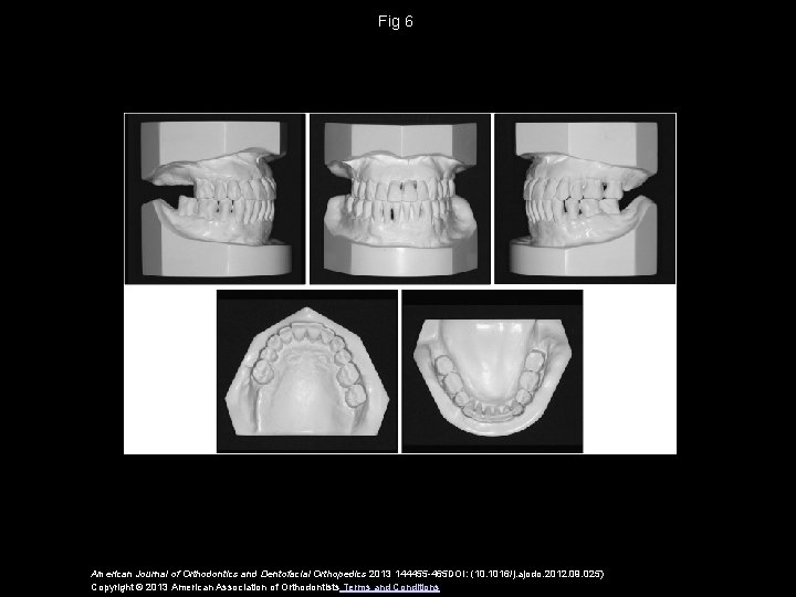 Fig 6 American Journal of Orthodontics and Dentofacial Orthopedics 2013 144455 -465 DOI: (10.