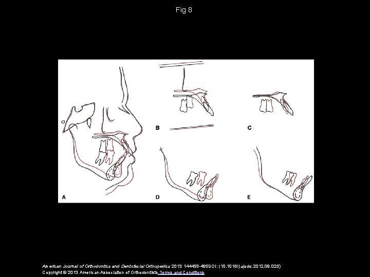 Fig 8 American Journal of Orthodontics and Dentofacial Orthopedics 2013 144455 -465 DOI: (10.