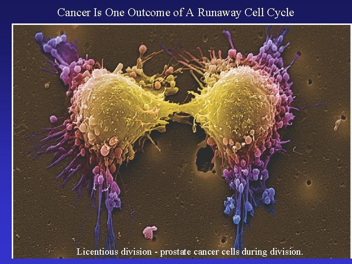 Cancer Is One Outcome of A Runaway Cell Cycle Licentious division - prostate cancer