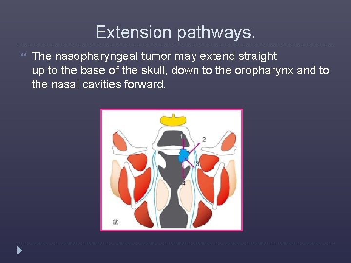 Extension pathways. The nasopharyngeal tumor may extend straight up to the base of the