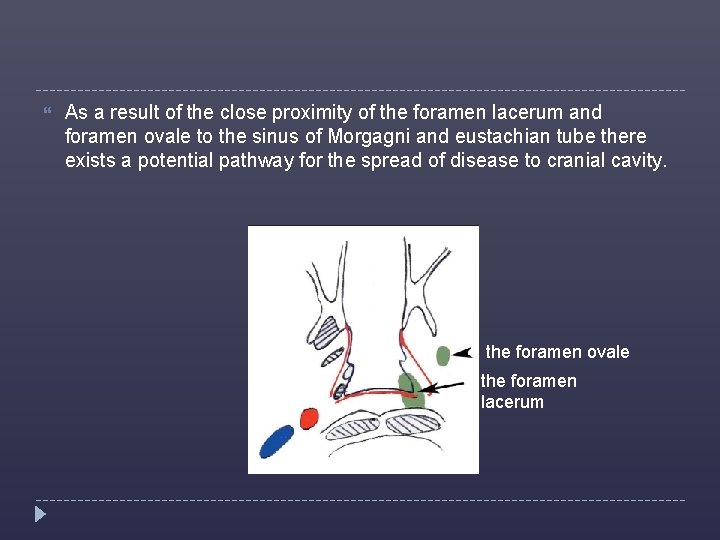  As a result of the close proximity of the foramen lacerum and foramen