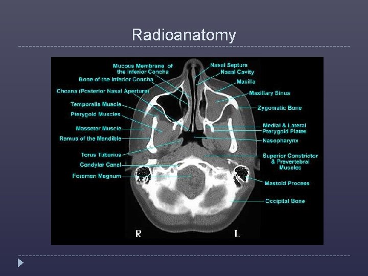 Radioanatomy 