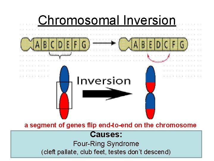 Chromosomal Inversion a segment of genes flip end-to-end on the chromosome Causes: Four-Ring Syndrome