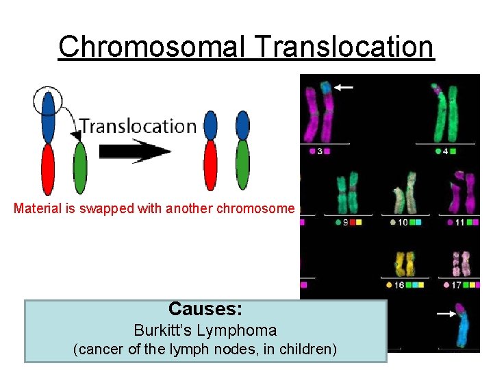 Chromosomal Translocation Material is swapped with another chromosome Causes: Burkitt’s Lymphoma (cancer of the