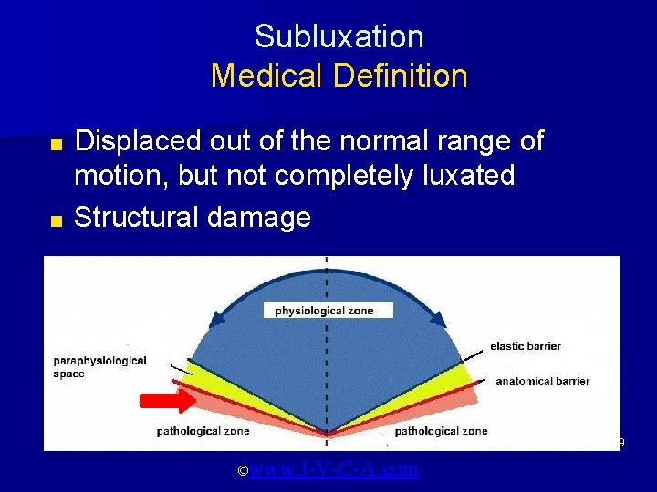 Subluxation Medical Definition Displaced out of the normal range of motion, but not completely