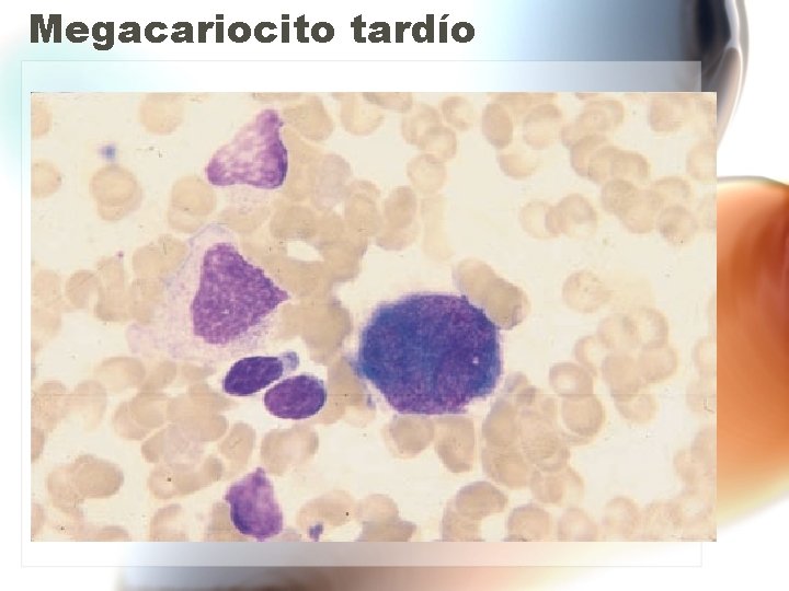 Megacariocito tardío Megacariocito tardío