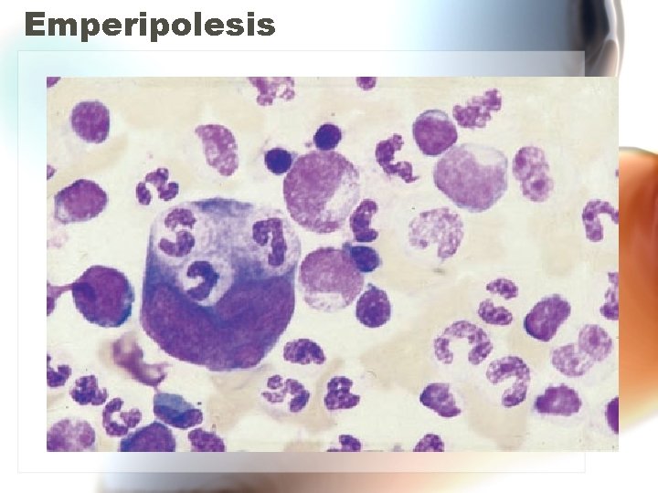 Emperipolesis Emperipolesis