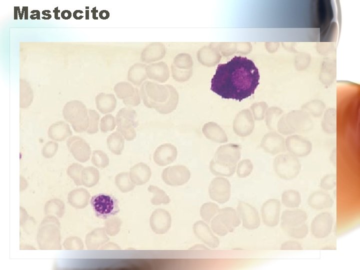 Mastocito Mastocito