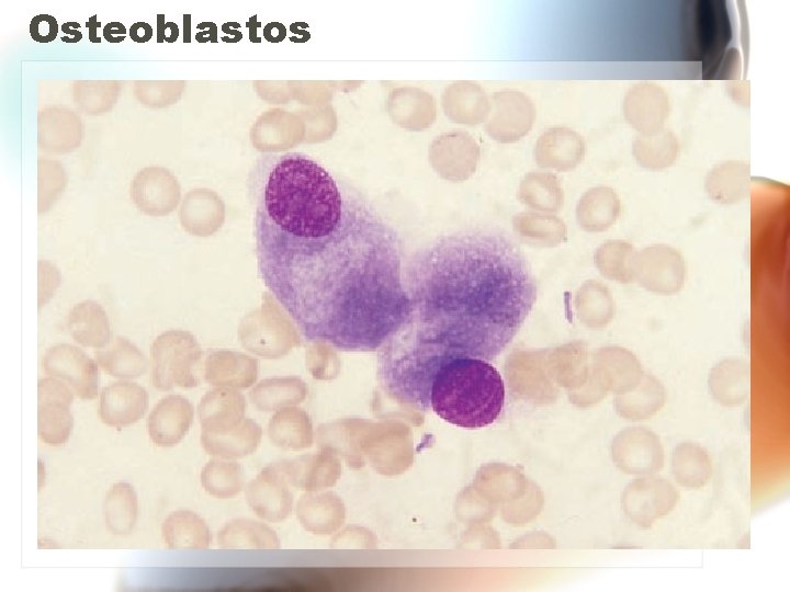 Osteoblastos Osteoblastos
